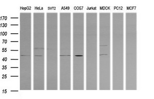 PARVA Antibody - Western blot of extracts (35ug) from 9 different cell lines by using anti-PARVA monoclonal antibody (HepG2: human; HeLa: human; SVT2: mouse; A549: human; COS7: monkey; Jurkat: human; MDCK: canine; PC12: rat; MCF7: human).