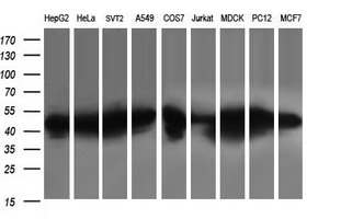 PARVA Antibody - Western blot of extracts (35ug) from 9 different cell lines by using anti-PARVA monoclonal antibody (HepG2: human; HeLa: human; SVT2: mouse; A549: human; COS7: monkey; Jurkat: human; MDCK: canine; PC12: rat; MCF7: human).