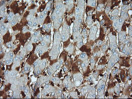 PARVA Antibody - IHC of paraffin-embedded Human liver tissue using anti-PARVA mouse monoclonal antibody.