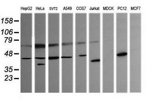 PARVA Antibody - Western blot of extracts (35 ug) from 9 different cell lines by using anti-PARVA monoclonal antibody (HepG2: human; HeLa: human; SVT2: mouse; A549: human; COS7: monkey; Jurkat: human; MDCK: canine; PC12: rat; MCF7: human).