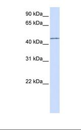 PARVB Antibody - Transfected 293T cell lysate. Antibody concentration: 1.0 ug/ml. Gel concentration: 12%.  This image was taken for the unconjugated form of this product. Other forms have not been tested.