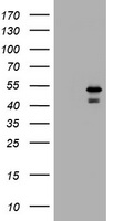 PARVB Antibody - HEK293T cells were transfected with the pCMV6-ENTRY control (Left lane) or pCMV6-ENTRY PARVB (Right lane) cDNA for 48 hrs and lysed. Equivalent amounts of cell lysates (5 ug per lane) were separated by SDS-PAGE and immunoblotted with anti-PARVB.