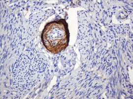 PARVB Antibody - IHC of paraffin-embedded Human endometrium tissue using anti-PARVB mouse monoclonal antibody.