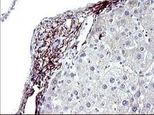 PARVB Antibody - IHC of paraffin-embedded Human liver tissue using anti-PARVB mouse monoclonal antibody. (Heat-induced epitope retrieval by 10mM citric buffer, pH6.0, 120°C for 3min).