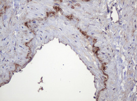PARVB Antibody - IHC of paraffin-embedded Human pancreas tissue using anti-PARVB mouse monoclonal antibody.