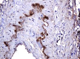 PARVB Antibody - IHC of paraffin-embedded Human pancreas tissue using anti-PARVB mouse monoclonal antibody. (Heat-induced epitope retrieval by 10mM citric buffer, pH6.0, 120°C for 3min).