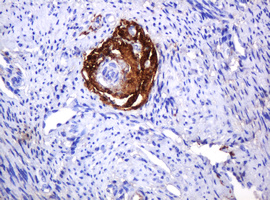 PARVB Antibody - IHC of paraffin-embedded Human endometrium tissue using anti-PARVB mouse monoclonal antibody. (Heat-induced epitope retrieval by 10mM citric buffer, pH6.0, 120°C for 3min).