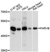 PARVB Antibody - Western blot analysis of extracts of various cell lines, using PARVB antibody at 1:3000 dilution. The secondary antibody used was an HRP Goat Anti-Rabbit IgG (H+L) at 1:10000 dilution. Lysates were loaded 25ug per lane and 3% nonfat dry milk in TBST was used for blocking. An ECL Kit was used for detection and the exposure time was 90s.
