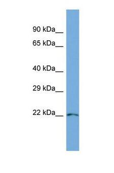 PARVG Antibody - Western blot of Human HeLa. PARVG antibody dilution 1.0 ug/ml.  This image was taken for the unconjugated form of this product. Other forms have not been tested.