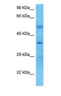 PARVG Antibody - Western blot of PARVG Antibody with human Large intestine Tumor lysate.  This image was taken for the unconjugated form of this product. Other forms have not been tested.