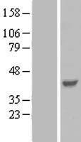 PARVG Protein - Western validation with an anti-DDK antibody * L: Control HEK293 lysate R: Over-expression lysate
