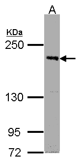 PAS Kinase / PASK Antibody - Sample (30g whole cell lysate). A: Raji . 5% SDS PAGE. PAS Kinase / PASK antibody diluted at 1:1000