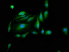 PAS Kinase / PASK Antibody - Immunofluorescence staining of Hela cells at a dilution of 1:200, counter-stained with DAPI. The cells were fixed in 4% formaldehyde, permeabilized using 0.2% Triton X-100 and blocked in 10% normal Goat Serum. The cells were then incubated with the antibody overnight at 4 °C.The secondary antibody was Alexa Fluor 488-congugated AffiniPure Goat Anti-Rabbit IgG (H+L) .