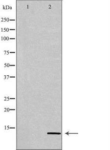 PATE3 Antibody - Western blot analysis of extracts of HeLa cells using PATE3 antibody. The lane on the left is treated with the antigen-specific peptide.