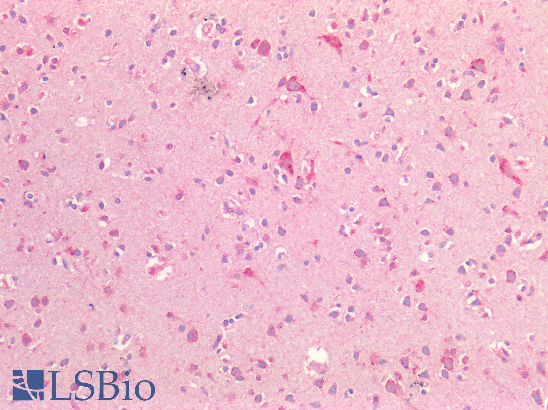 5-Alpha Reductase / SRD5A1 Antibody - Human Brain, Cortex: Formalin-Fixed, Paraffin-Embedded (FFPE)