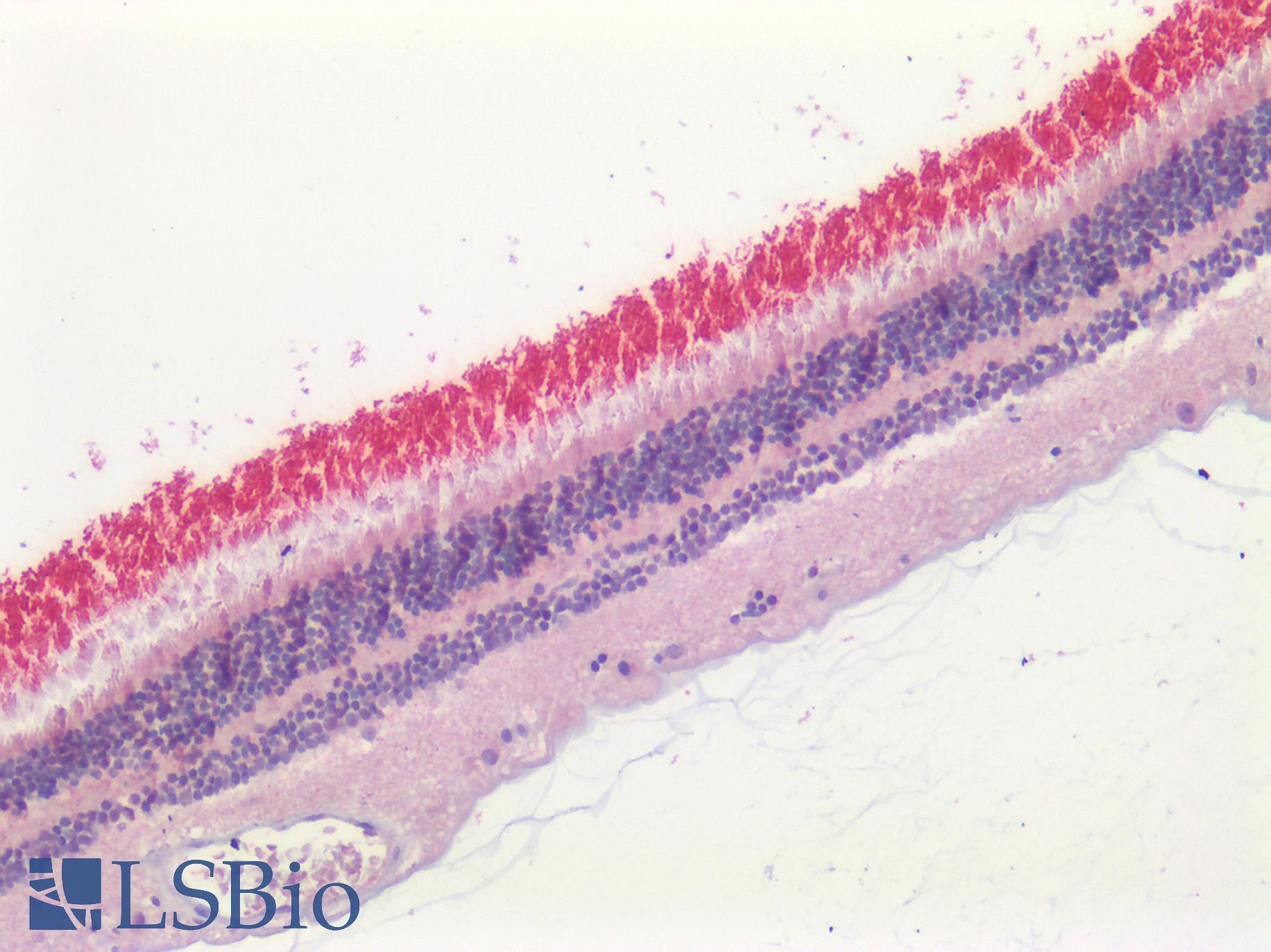 ABCA4 Antibody - Human Retina: Formalin-Fixed, Paraffin-Embedded (FFPE)