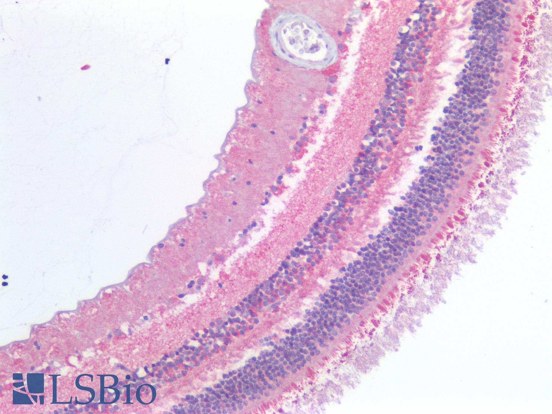 ABCA4 Antibody - Human Retina: Formalin-Fixed, Paraffin-Embedded (FFPE)