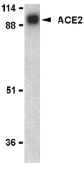 ACE2 / ACE-2 Antibody - Western blot of ACE2 in human kidney lysate with ACE2 antibody at 1 ug/ml.