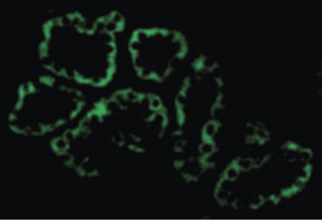 ACE2 / ACE-2 Antibody - Immunofluorescence of ACE2 in Human Kidney cells with ACE2 antibody at 2 ug/ml.