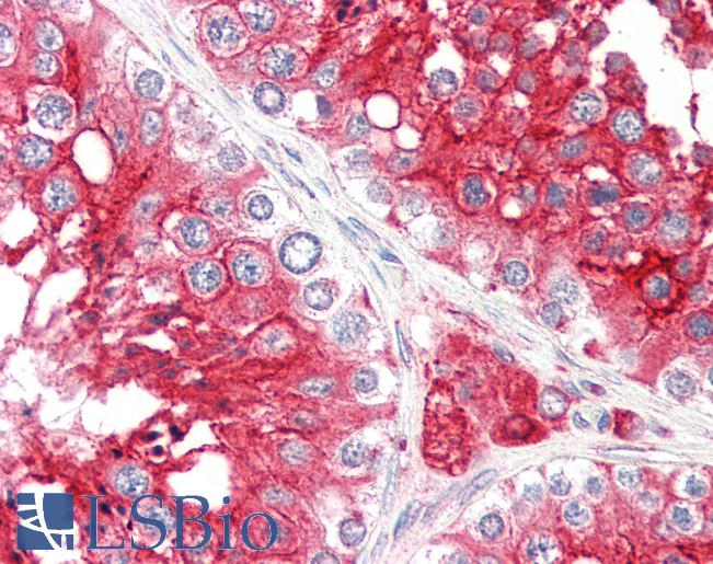 ACE2 / ACE-2 Antibody - Anti-ACE-2 antibody IHC of human testis. Immunohistochemistry of formalin-fixed, paraffin-embedded tissue after heat-induced antigen retrieval. Antibody concentration 5 ug/ml.