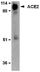 ACE2 / ACE-2 Antibody - Western blot of ACE2 in human kidney lysate with ACE2 antibody at 2 ug/ml.