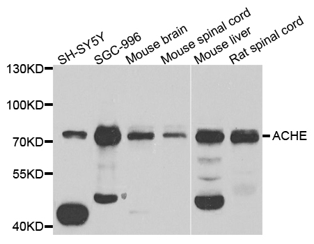 ACHE / Acetylcholinesterase Antibody - Western blot blot of extract of various cells, using ACHE antibody.