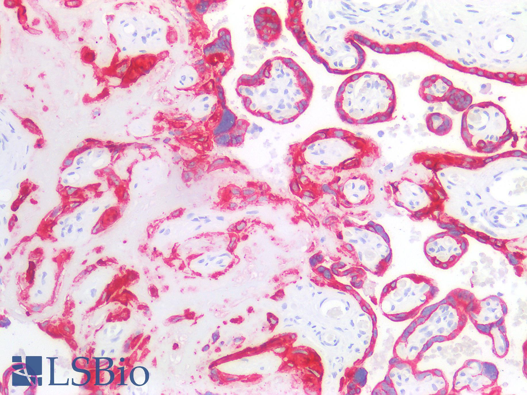 Acidic Cytokeratin AE1 Antibody - Human Placenta: Formalin-Fixed, Paraffin-Embedded (FFPE)
