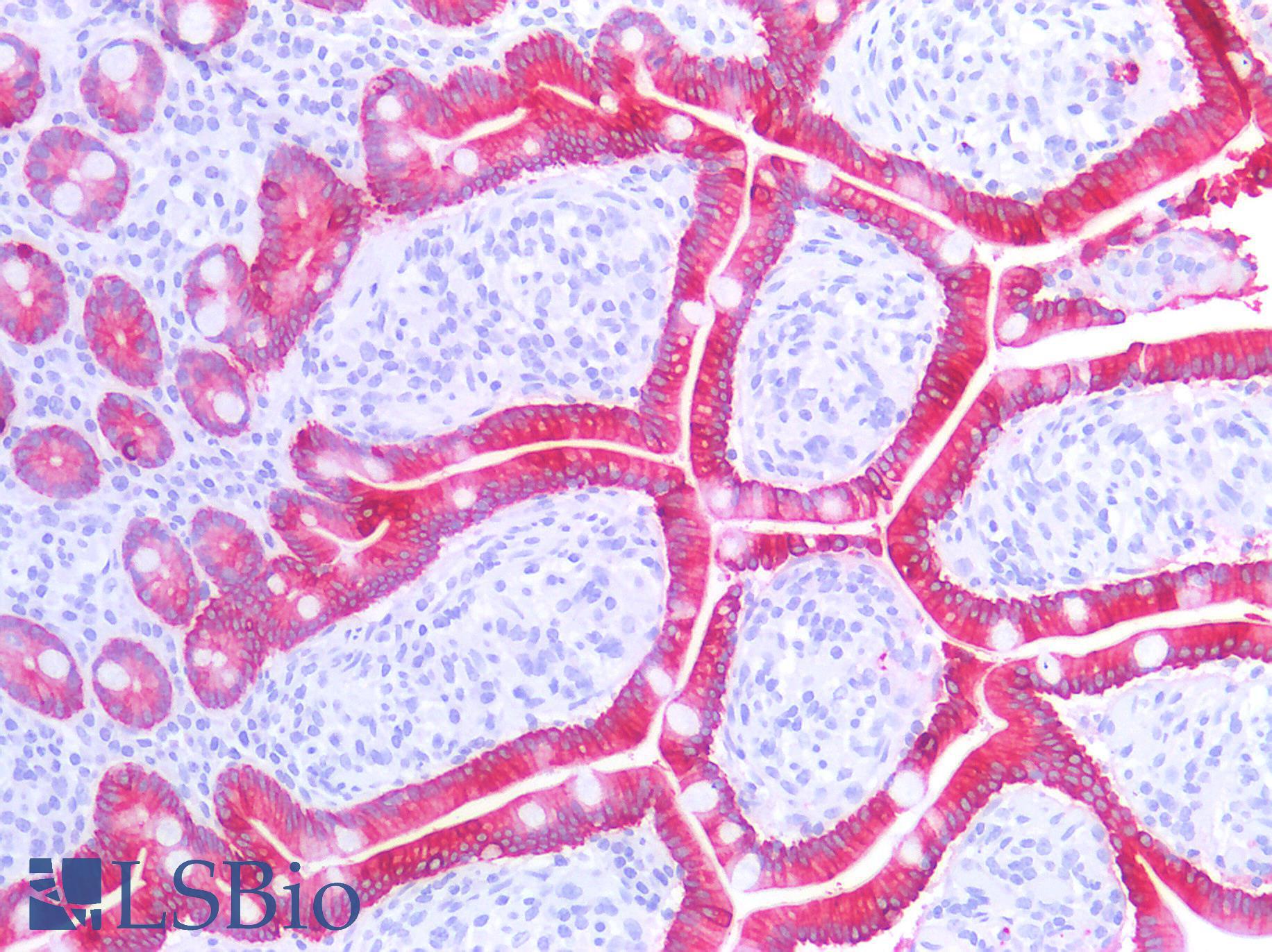 Acidic Cytokeratin AE1 Antibody - Human Small Intestine: Formalin-Fixed, Paraffin-Embedded (FFPE)