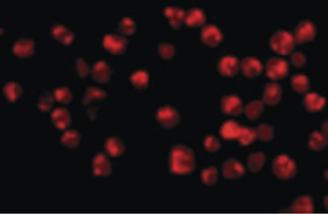 ACIN1 / Acinus Antibody - Immunofluorescence of Acinus in K562 cells with Acinus antibody at 20 ug/ml.