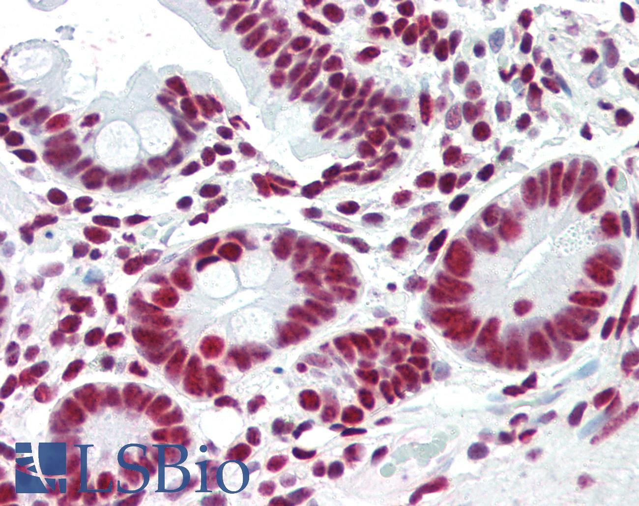 ACIN1 / Acinus Antibody - Anti-ACIN1 / Acinus antibody IHC of human small intestine. Immunohistochemistry of formalin-fixed, paraffin-embedded tissue after heat-induced antigen retrieval. Antibody concentration 5 ug/ml.
