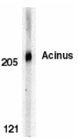 ACIN1 / Acinus Antibody - Western blot of Acinus in K562 whole cell lysate with Acinus antibody at 0.5 ug/ml.