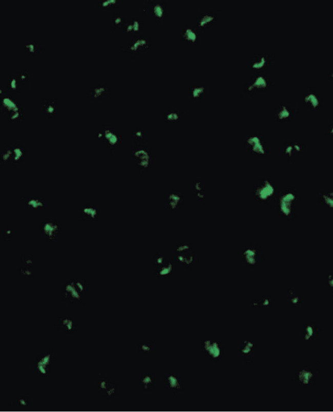 ACIN1 / Acinus Antibody - Immunofluorescence of Acinus in K562 cells with Acinus antibody at 20 ug/ml.