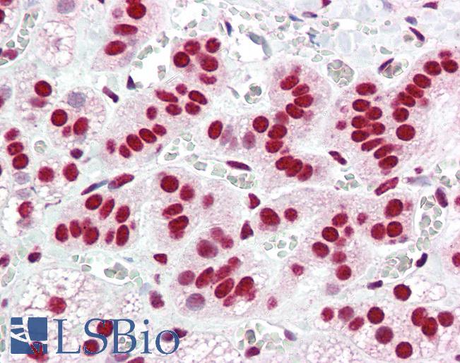 ACIN1 / Acinus Antibody - Anti-ACIN1 / Acinus antibody IHC of human adrenal. Immunohistochemistry of formalin-fixed, paraffin-embedded tissue after heat-induced antigen retrieval. Antibody concentration 5 ug/ml.