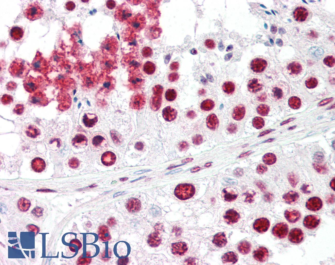 ACIN1 / Acinus Antibody - Anti-ACIN1 / Acinus antibody IHC of human testis. Immunohistochemistry of formalin-fixed, paraffin-embedded tissue after heat-induced antigen retrieval. Antibody concentration 5 ug/ml.