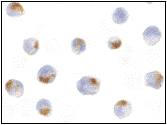 ACIN1 / Acinus Antibody - Immunocytochemistry of Acinus in K562 cells with Acinus antibody at 5 µg/ml.