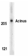 ACIN1 / Acinus Antibody - Western blot of Acinus in K562 whole cell lysate with Acinus antibody at 1 ug/ml.