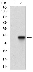 ACP5 / TRAP Antibody - Western blot using ACP5 monoclonal antibody against HEK293 (1) and ACP5 (AA: 221-325)-hIgGFc transfected HEK293 (2) cell lysate.