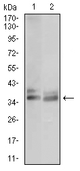 ACP5 / TRAP Antibody - Western blot using ACP5 mouse monoclonal antibody against JURKAT (1) and OCM-1 (2) cell lysate.