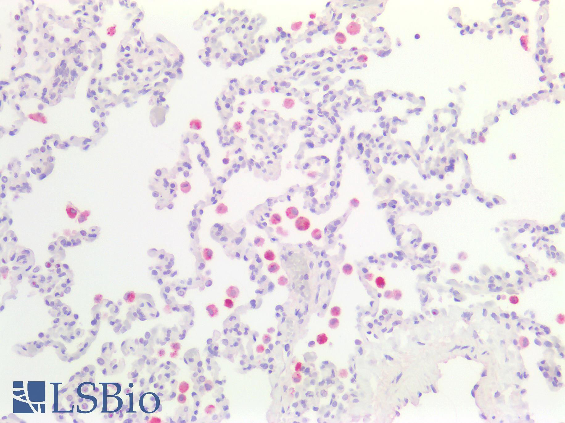 ACP5 / TRAP Antibody - Human Lung: Formalin-Fixed, Paraffin-Embedded (FFPE)