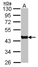 ACTA1 / Skeletal Muscle Actin Antibody - Sample(30 g of whole cell lysate). A: Raji. 10% SDS PAGE. ACTA1 antibody diluted at 1:1000.