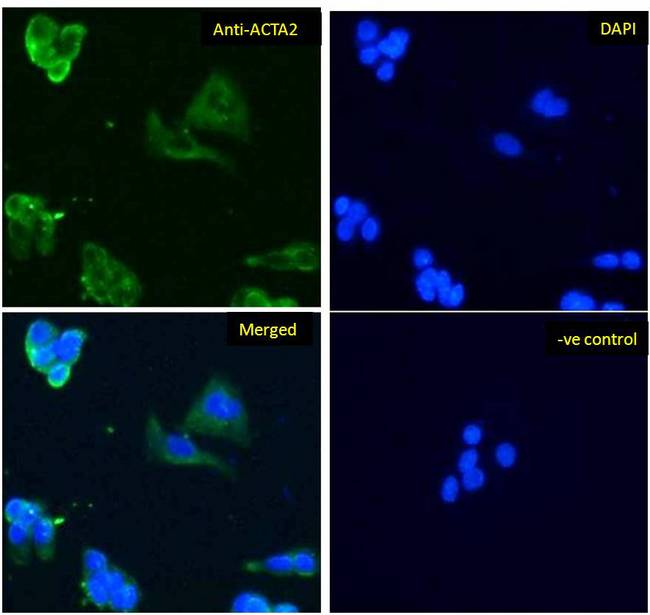 ACTA2 / Smooth Muscle Actin Antibody - ACTA2 / Smooth Muscle Actin antibody immunofluorescence analysis of paraformaldehyde fixed HepG2 cells, permeabilized with 0.15% Triton. Primary incubation 1hr (10ug/ml) followed by Alexa Fluor 488 secondary antibody (1ug/ml), showing cytoplasmic staining. The nuclear stain is DAPI (blue). Negative control: Unimmunized goat IgG (10ug/ml) followed by Alexa Fluor 488 secondary antibody (2ug/ml).