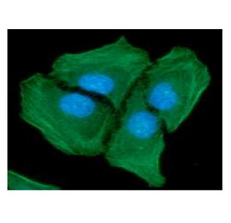 ACTA2 / Smooth Muscle Actin Antibody - ICC/IF analysis of ACTA2 in HeLa cells line, stained with DAPI (Blue) for nucleus staining and monoclonal anti-human ACTA2 antibody (1:100) with goat anti-mouse IgG-Alexa fluor 488 conjugate (Green).