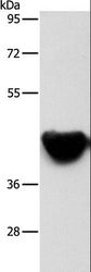 ACTA2 / Smooth Muscle Actin Antibody - Western blot analysis of Mouse heart tissue, using ACTA2 Polyclonal Antibody at dilution of 1:500.