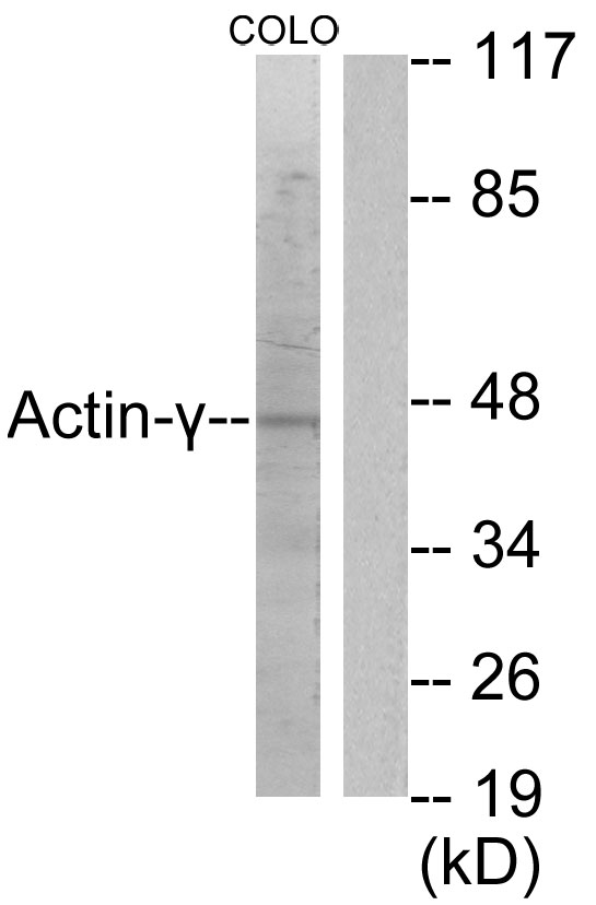 ACTG2 Antibody - Western blot analysis of lysates from COLO205 cells, using Actin-gamma2 Antibody. The lane on the right is blocked with the synthesized peptide.