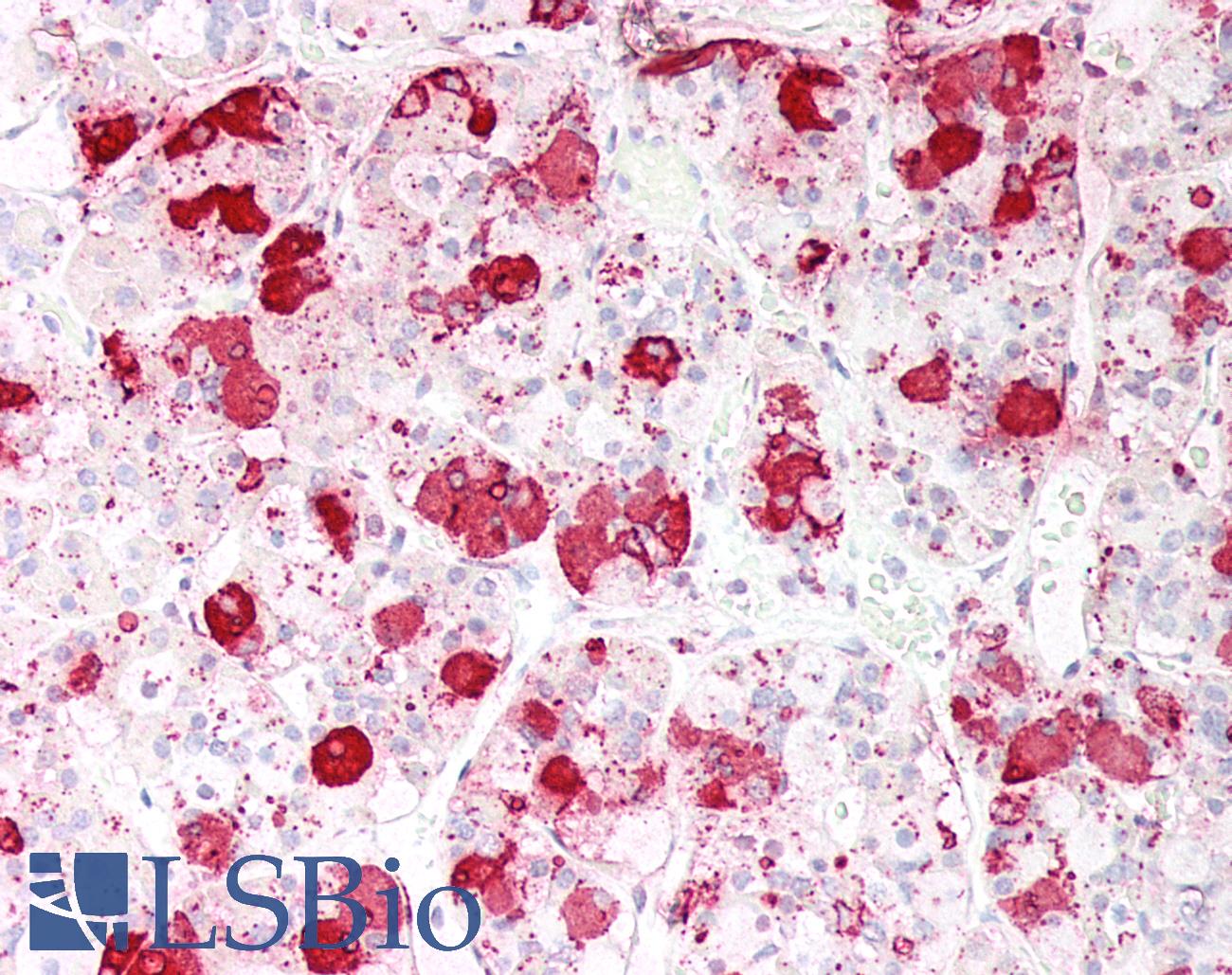 ACTH Antibody - Human Anterior Pituitary: Formalin-Fixed, Paraffin-Embedded (FFPE)