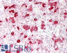 ACTH Antibody - Human Anterior Pituitary: Formalin-Fixed, Paraffin-Embedded (FFPE)
