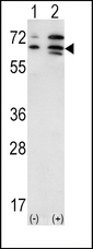 ACVR2 / ACVR2A Antibody - Western blot of anti-ACVR2A Antibody in mouse liver(lane 1) brain(lane 2) and kidney(lane 3) tissue lysates (35 ug/lane). ACVR2A (arrow) was detected using the purified antibody.