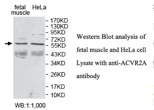 ACVR2 / ACVR2A Antibody
