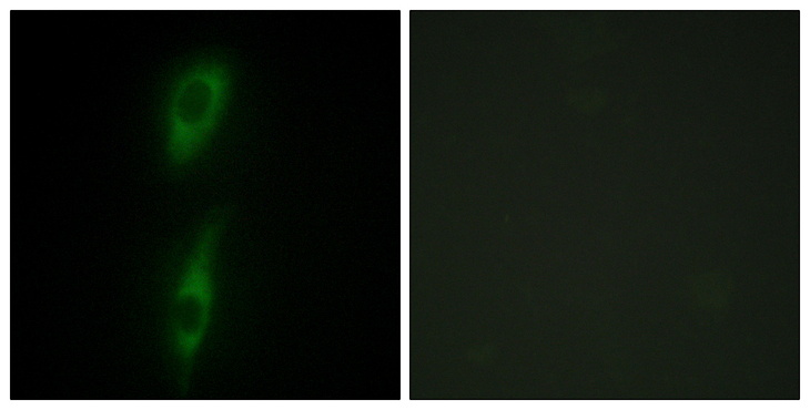 ACVRL1 Antibody - Immunofluorescence analysis of HeLa cells, using ACVL1 Antibody. The picture on the right is blocked with the synthesized peptide.