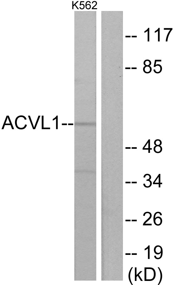 ACVRL1 Antibody - Western blot analysis of lysates from K562 cells, using ACVL1 Antibody. The lane on the right is blocked with the synthesized peptide.